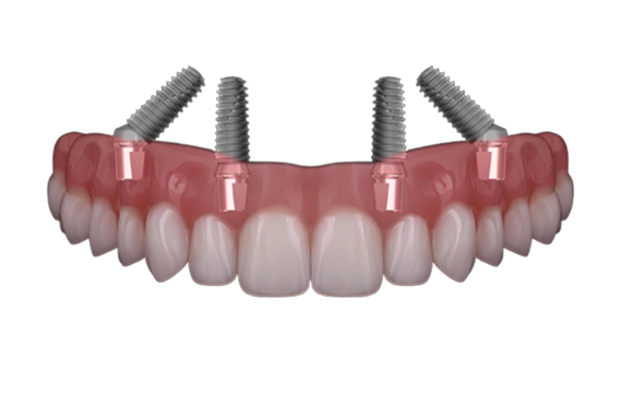 Teeth images