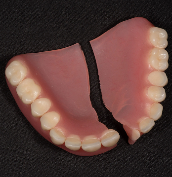 A broken removable denture